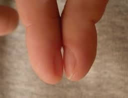 Acropachia