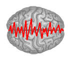 Epilessia