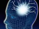 Epilessia