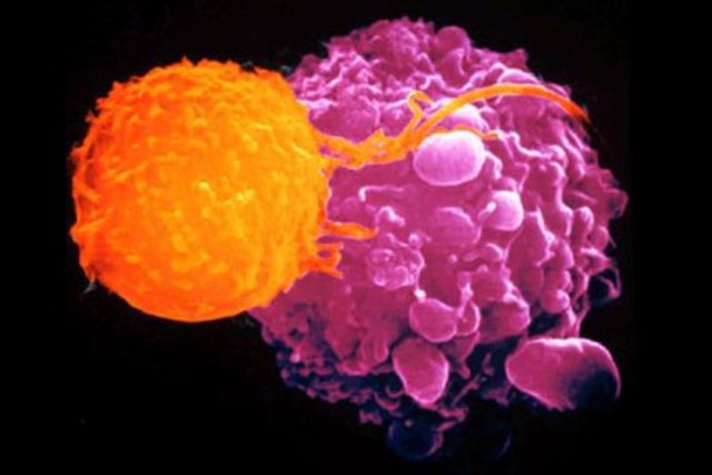Cellula linfoma primitivo