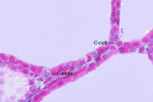 Cellula C Parafollicolare