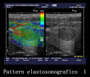 Pattern Elastosonografico 1