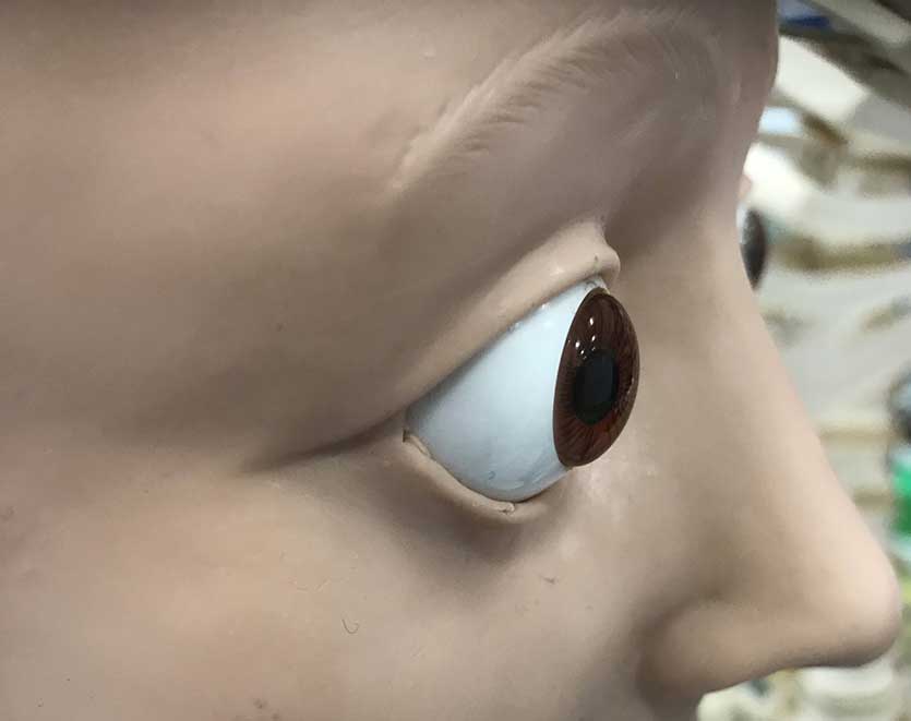 Terapia dell’esoftalmopatia di Basedow in fase attiva class=