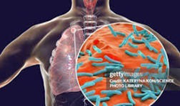 Terapia della tubercolosi e funzione tiroidea: interazioni farmacologiche e implicazioni cliniche